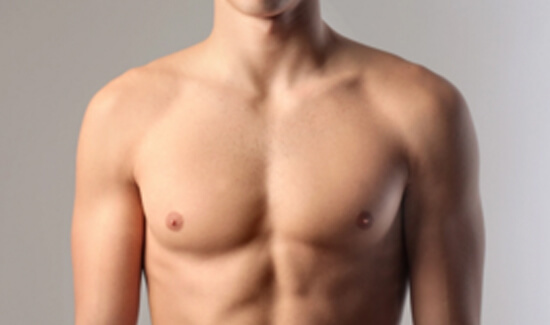 Picture of a man showing his chest and happy with his perfect male breast reduction procedure he had with Cancun MedVentures in beautiful Cancun, Mexico.  The man is shirtless and facing the camera and standing against a light purple background.