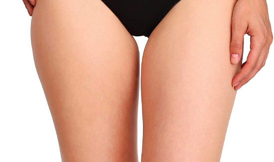Picture of a trim woman wearing a black bikini bottom, and happy with her perfect thigh lift she had with Cancun MedVentures in beautiful Cancun, Mexico.  The woman is facing the camera and has both arms down to her sides.